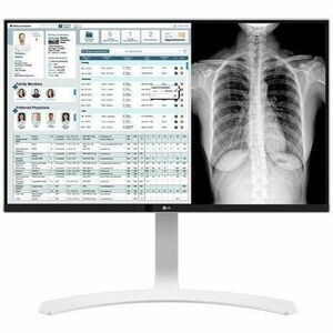 LG 27HJ712C-W 27IN CLINICAL 4K IPS MONITOR DICOM HDMI/DP HEIGHT ADJUST TILT PIVOT 350CD/M2 BRIGHTNESS VESA