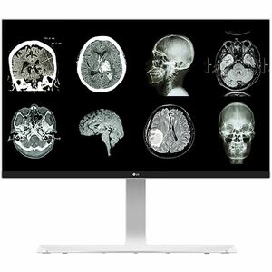 27HJ712C-W 27IN CLINICAL 4K IPS MONITOR DICOM HDMI/DP HEIGHT ADJUST TILT PIVOT 350CD/M2 BRIGHTNESS VESA